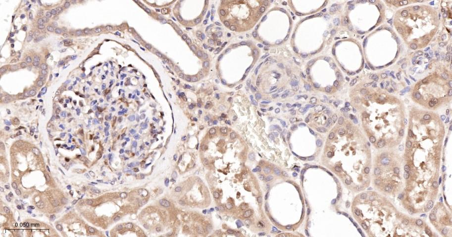 硫氧环蛋白还原酶1重组兔单抗
