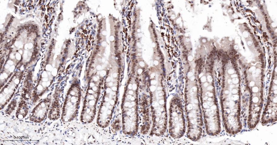 核糖核酸结合蛋白1重组兔单抗-bsm-60550R