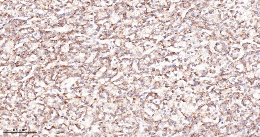 金属蛋白酶组织抑制因子-1重组兔单抗