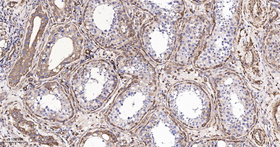 肌球蛋白调节轻链12B重组兔单抗