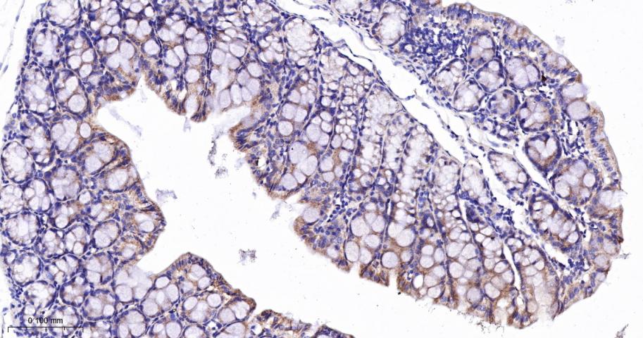 肉毒碱棕榈酰基转移酶2重组兔单抗