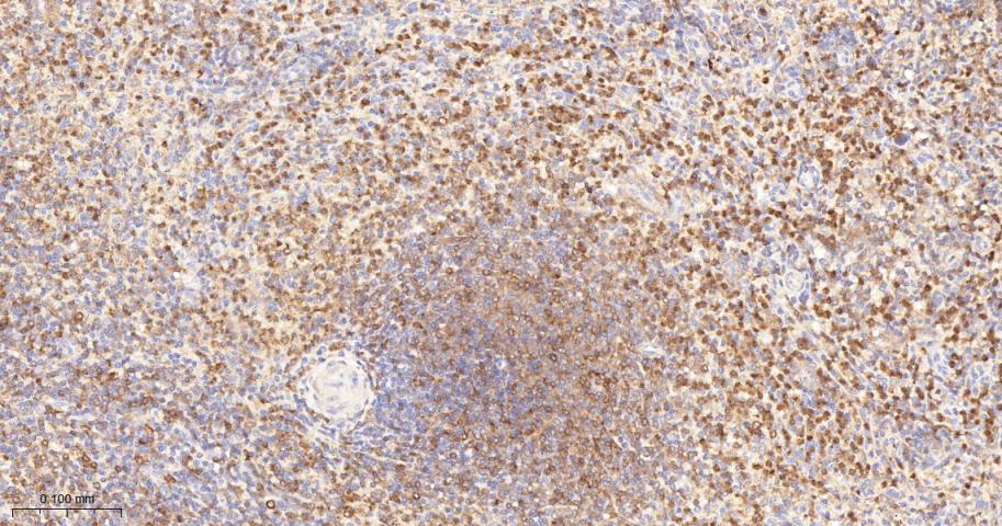 蛋白激酶C亚性D型重组兔单抗