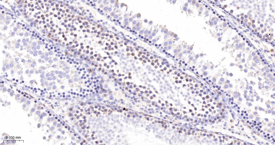 蛋白激酶C亚性D型重组兔单抗