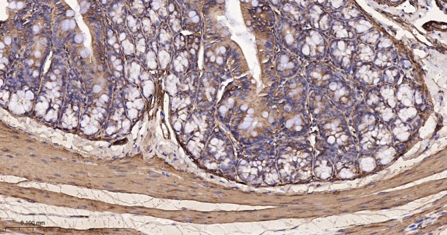 肌球蛋白调节轻链12B重组兔单抗