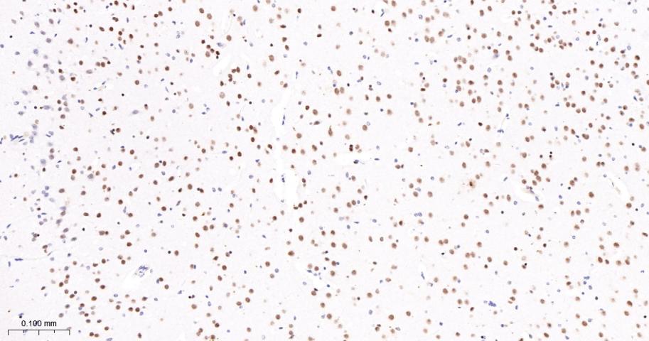 转录因子7类似物2重组兔单抗