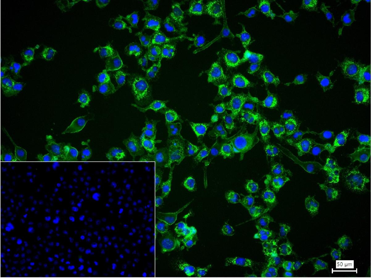 Ⅲ型胶原蛋白/胶原蛋白3/3型胶原蛋白/III型胶原抗体-bs-0549R