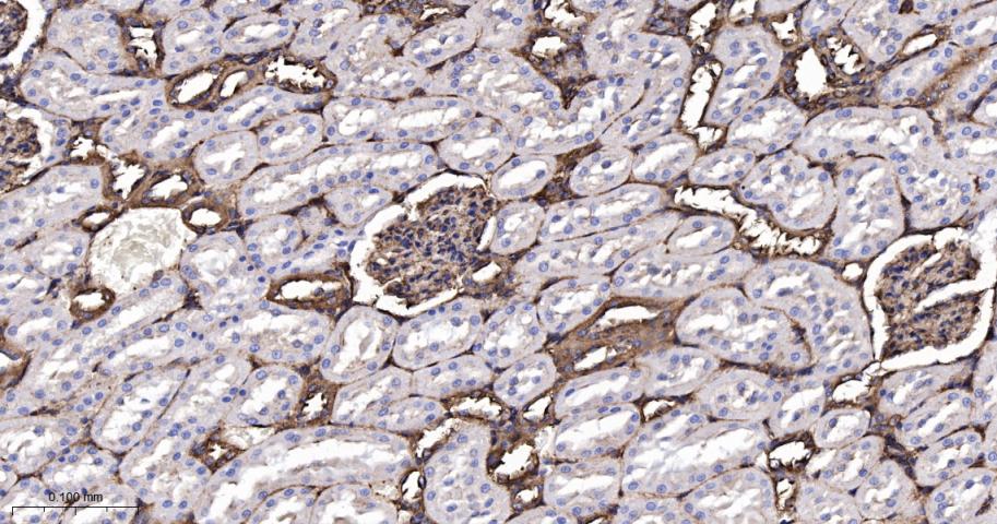 肌球蛋白调节轻链12B重组兔单抗