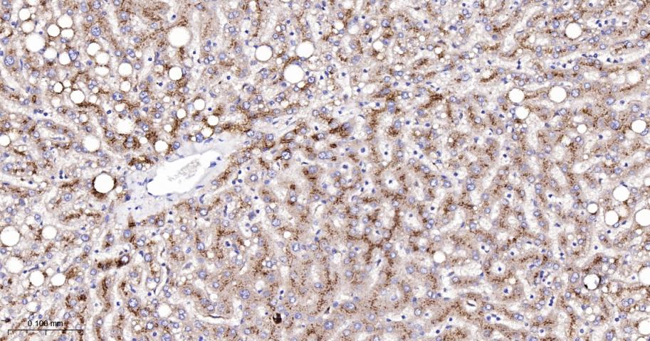 肉毒碱棕榈酰基转移酶2重组兔单抗