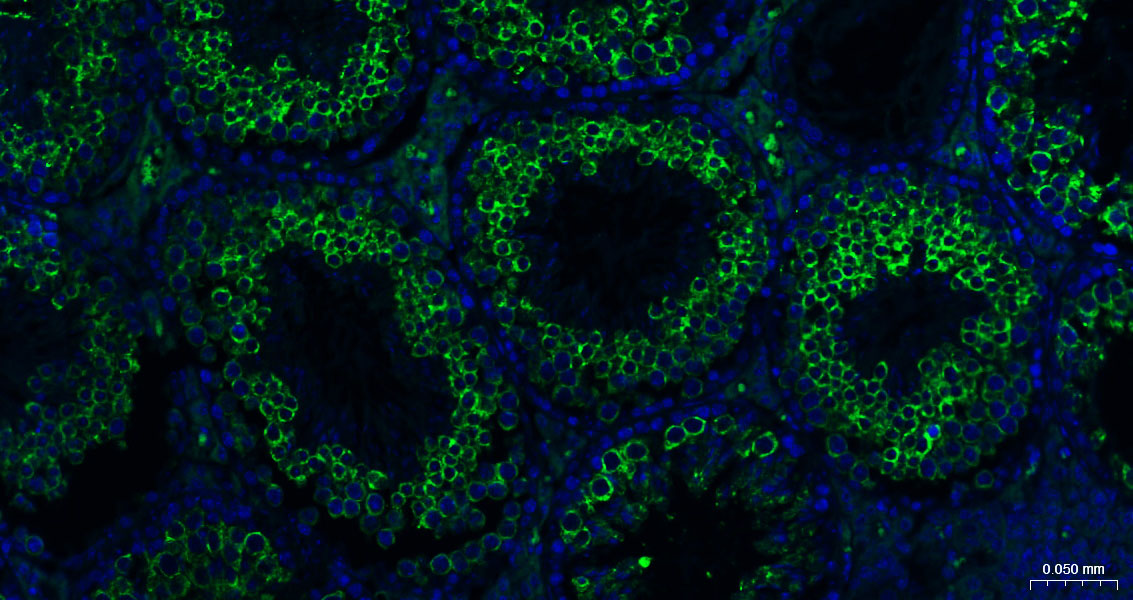 核因子2相关因子2重组兔单抗