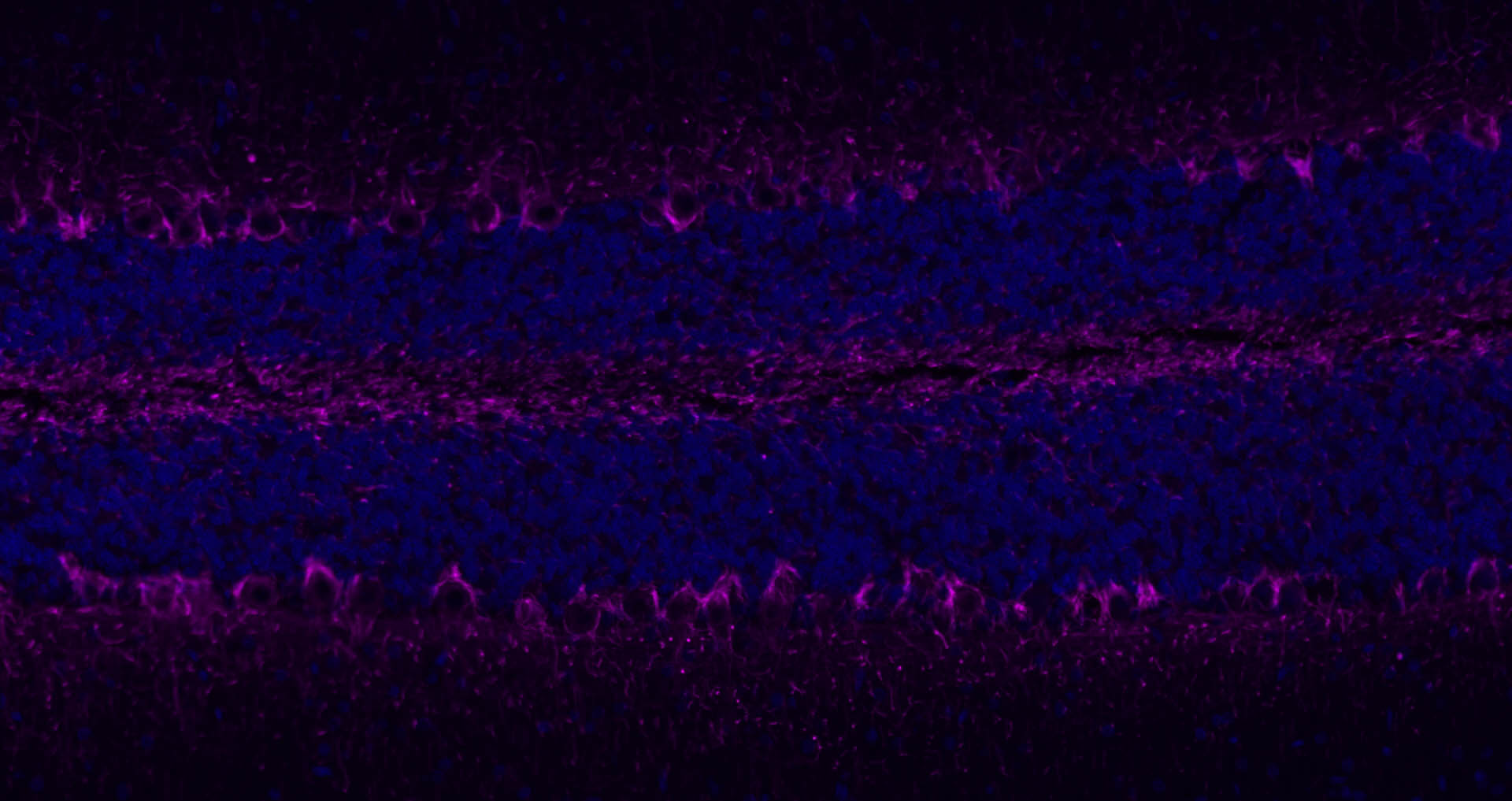 低分子量神经丝蛋白抗体-bs-0707R