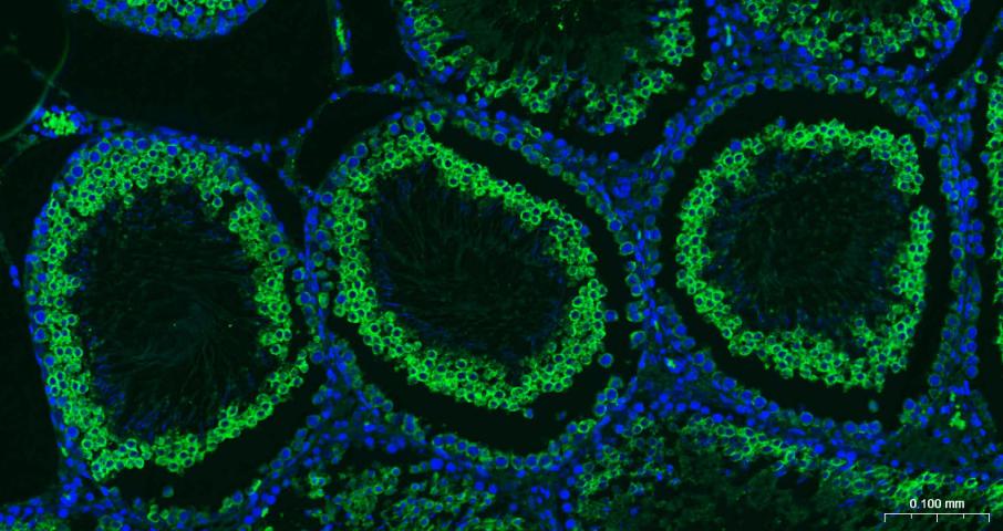 核因子2相关因子2重组兔单抗