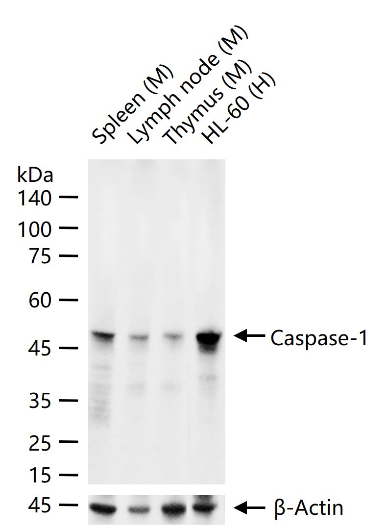 天冬氨酸-胱氨酸特异性蛋白酶家族1 重组兔单抗