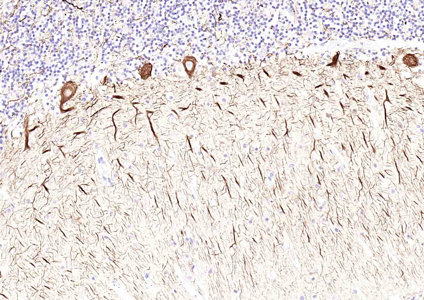 低分子量神经丝蛋白抗体-bs-0707R