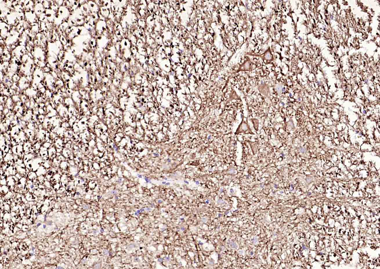 低分子量神经丝蛋白抗体-bs-0707R