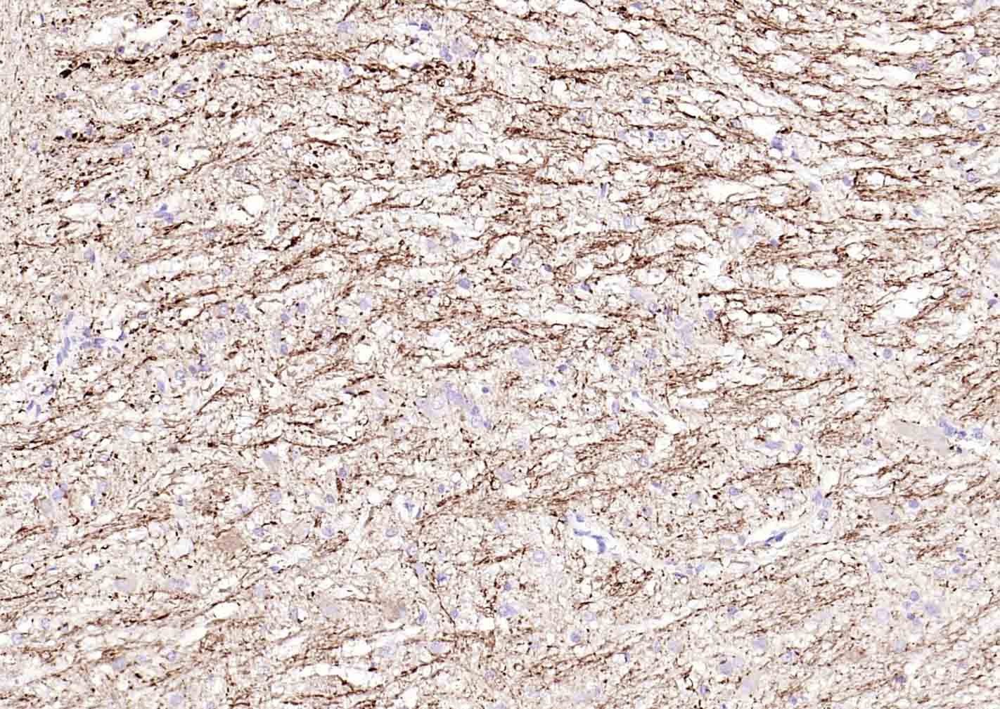 低分子量神经丝蛋白抗体-bs-0707R