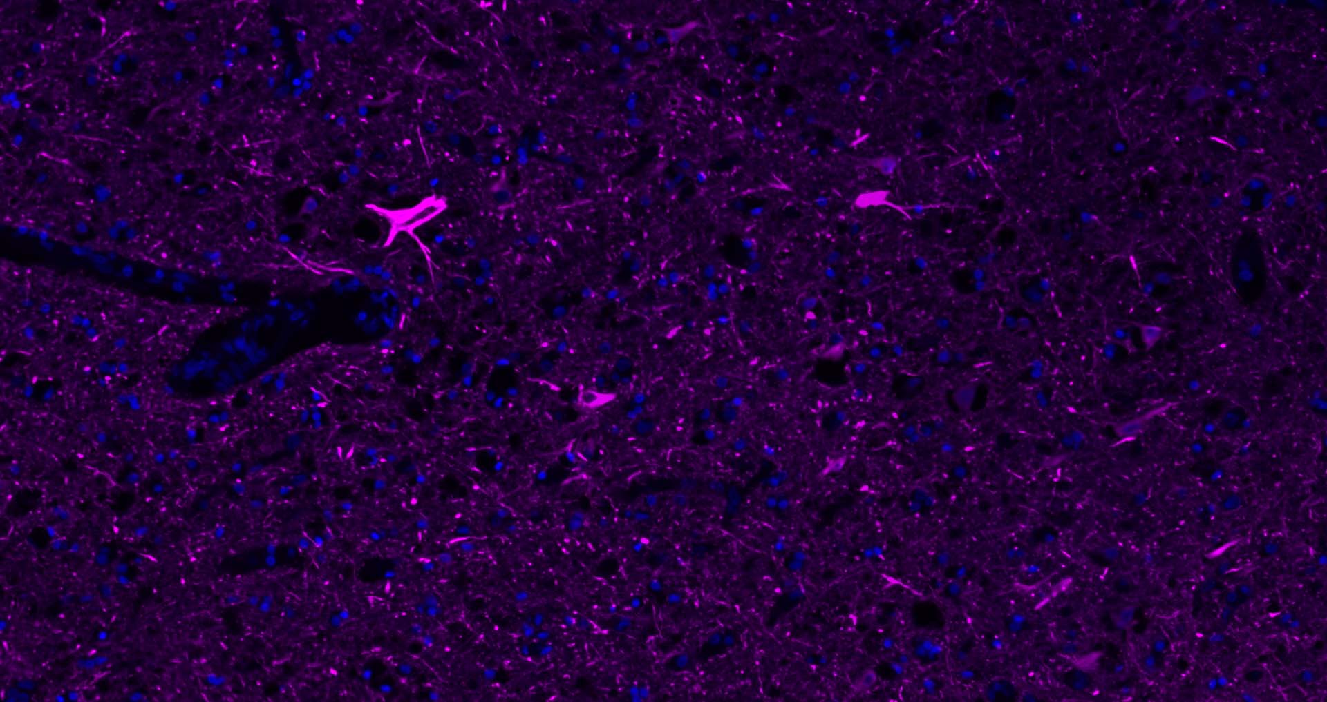 低分子量神经丝蛋白抗体-bs-0707R