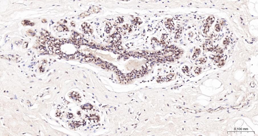 缺氧诱导因子1α抑制蛋白/HIF1AN重组兔单抗