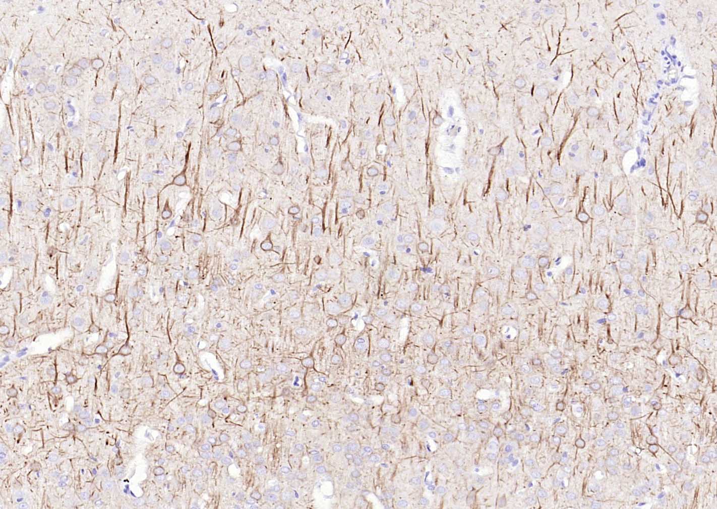 低分子量神经丝蛋白抗体-bs-0707R