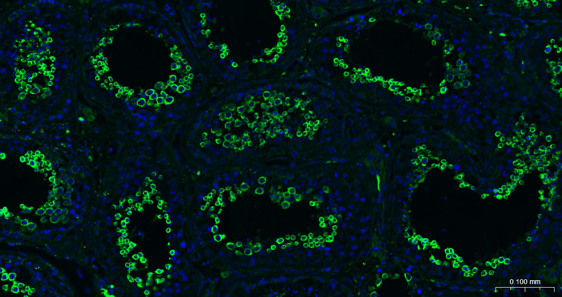 核因子2相关因子2重组兔单抗