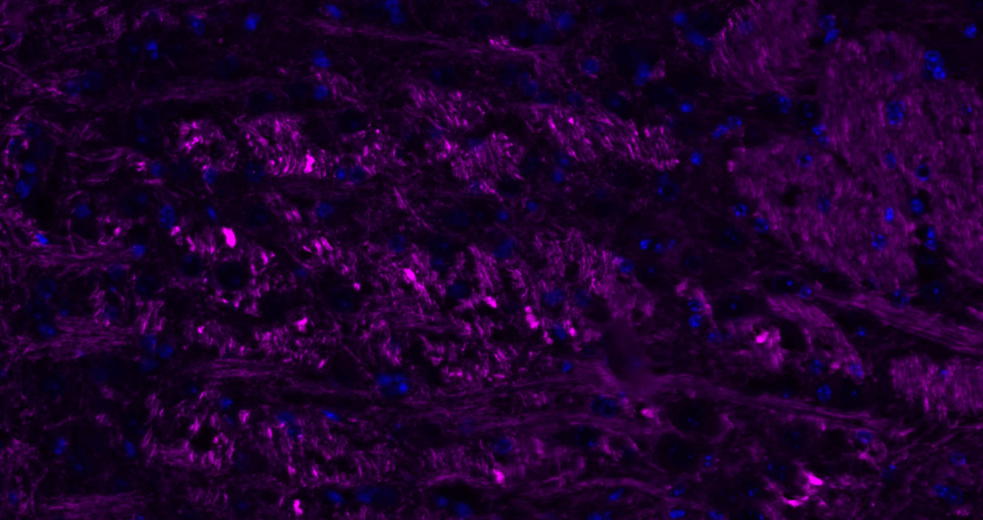 低分子量神经丝蛋白抗体-bs-0707R
