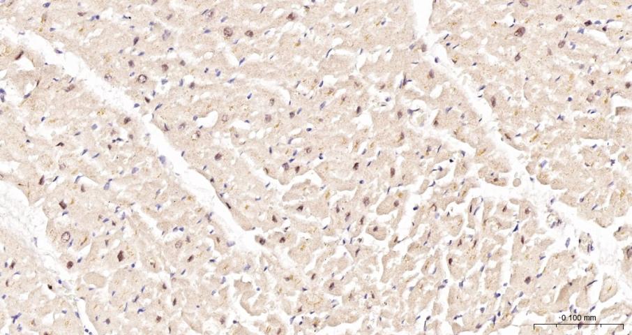 缺氧诱导因子1α抑制蛋白/HIF1AN重组兔单抗