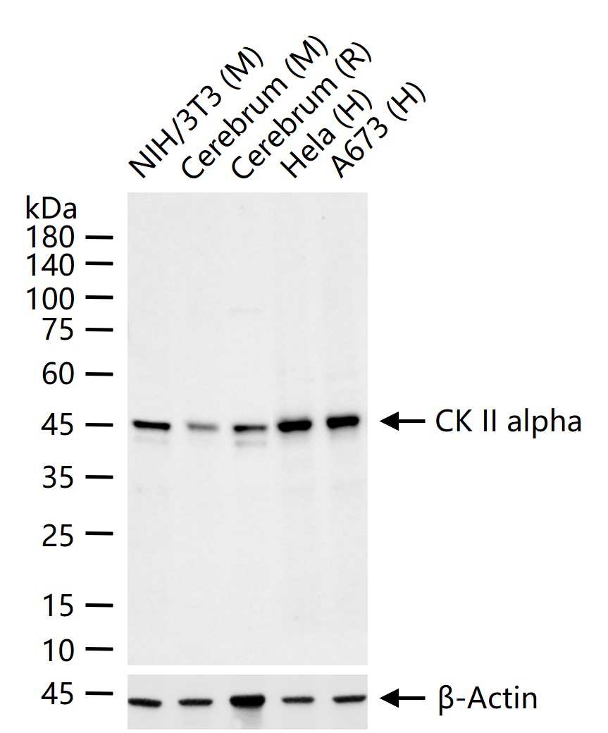 丝/苏氨酸蛋白质激酶II α重组兔单抗