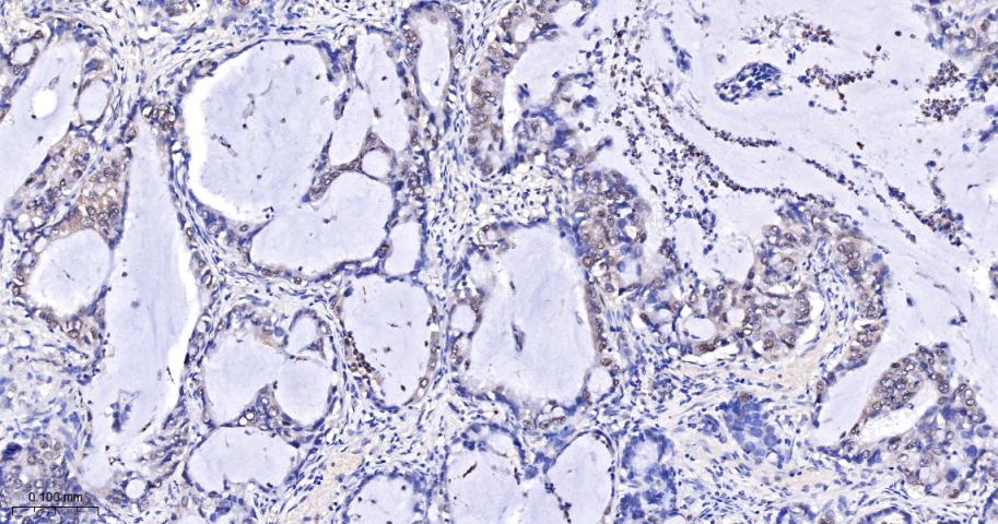 原癌基因Yes相关蛋白1重组兔单抗