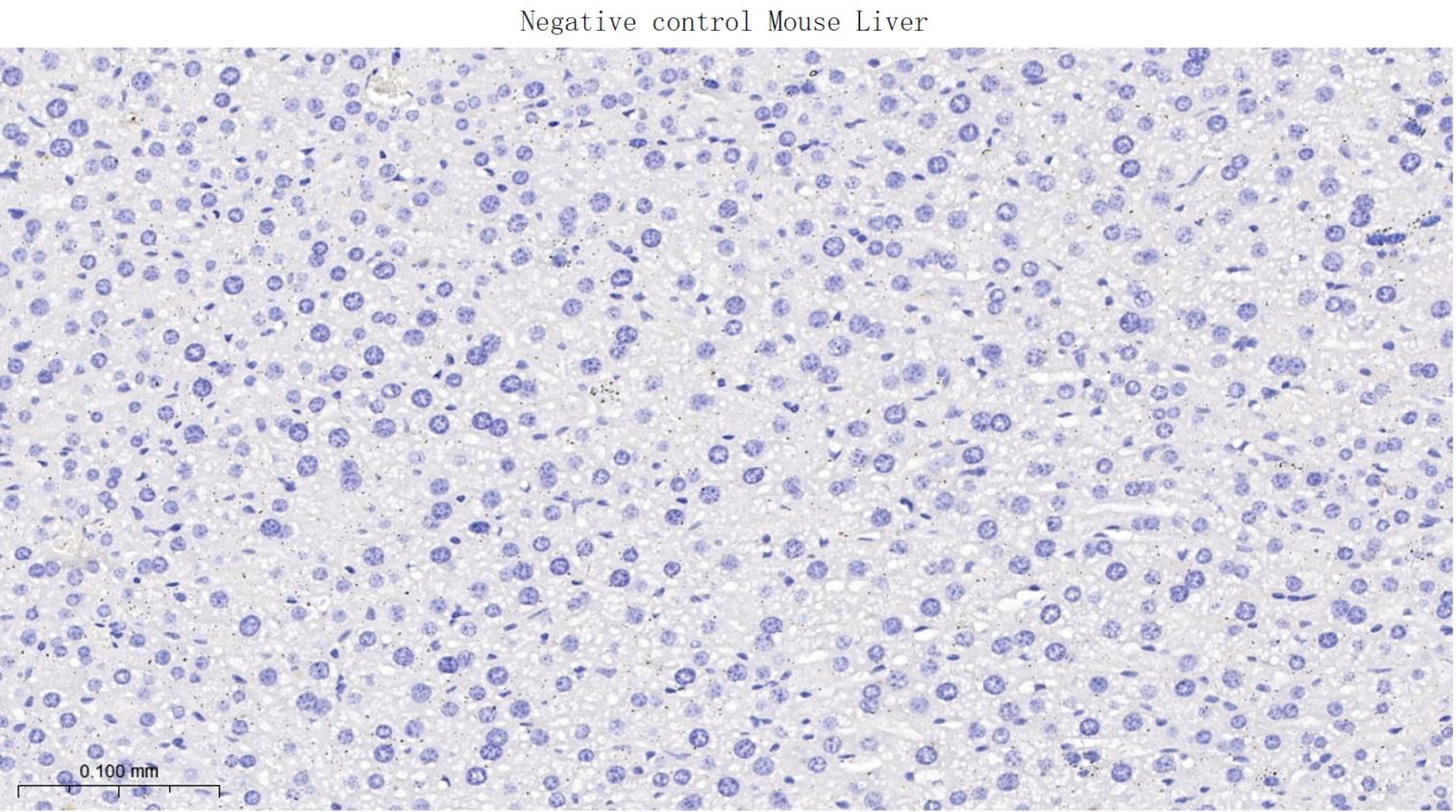 谷氨酸受体1重组兔单抗