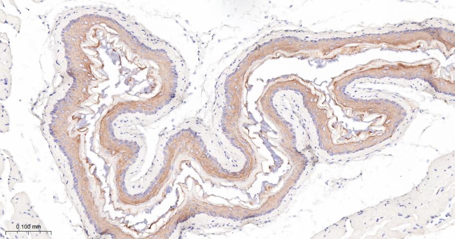 细胞角蛋白4重组兔单抗