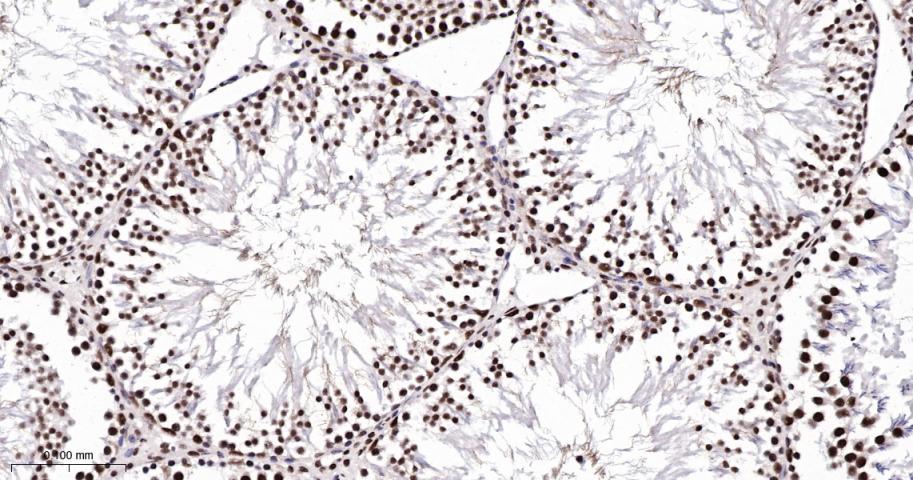 磷酸化细胞信号转导分子SMAD5重组兔单抗