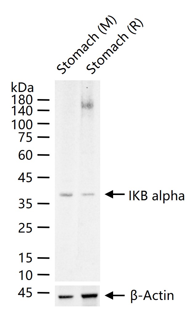 IKB alpha Rabbit pAb (一抗) - WB,IHC-P,IHC-F,IF,Flow-Cyt,ICC/IF | Bioss