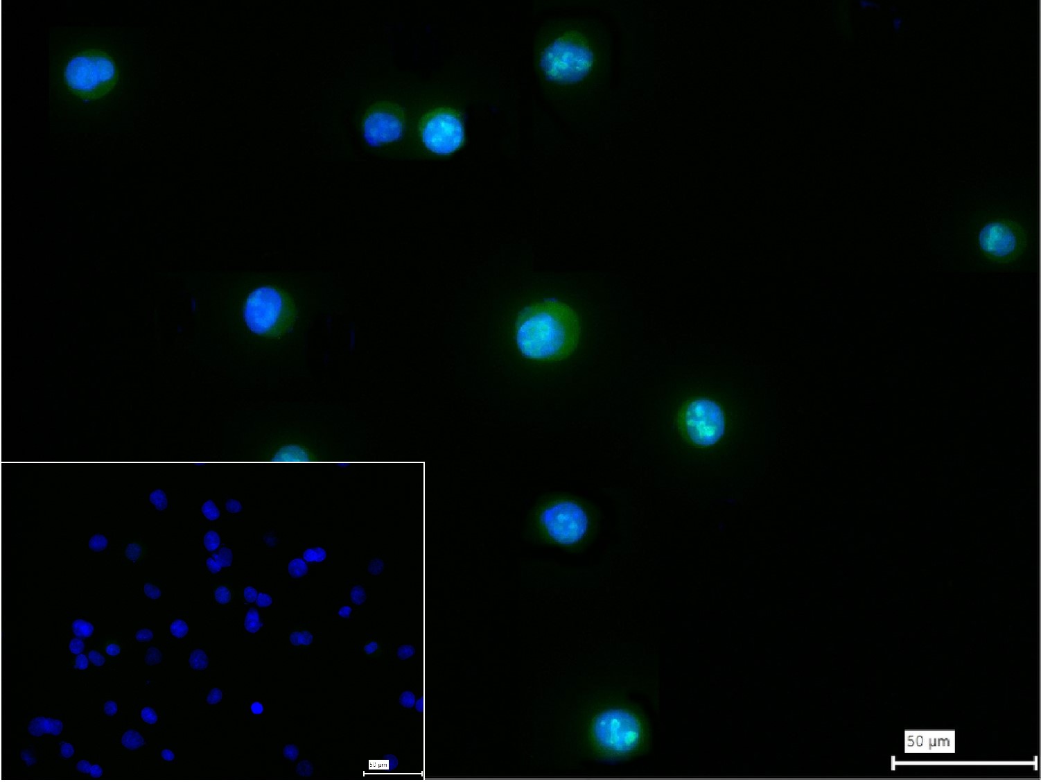 着丝粒蛋白C1重组兔单抗