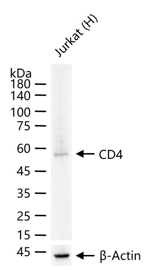 CD4重组兔单抗