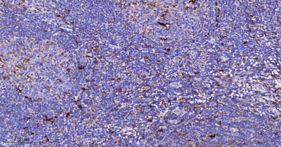 α-1抗胰糜蛋白酶/SERPINA3重组兔单克隆抗体