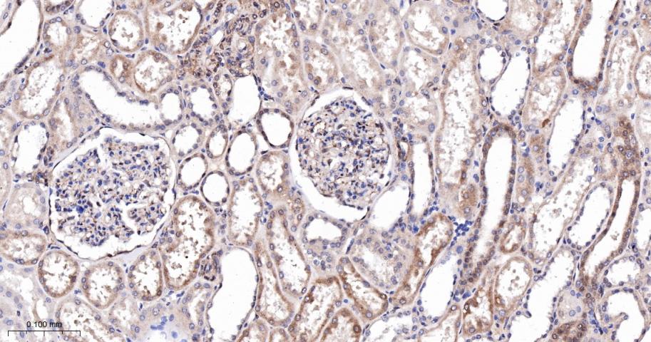 原癌基因Yes相关蛋白1重组兔单抗