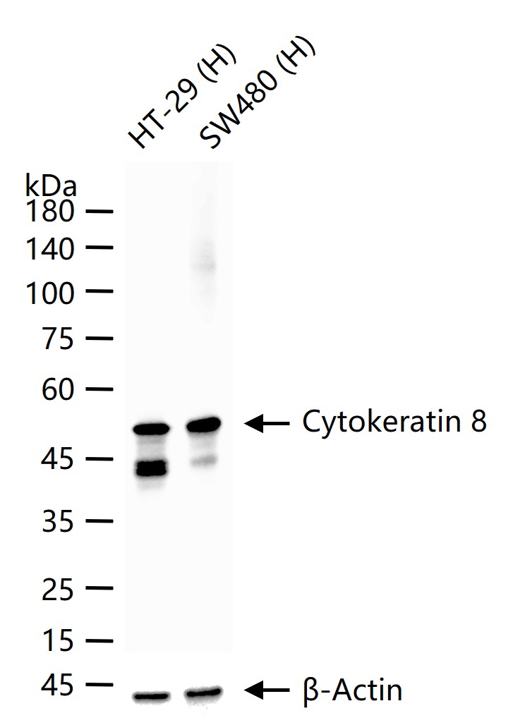 细胞角蛋白8重组兔单抗