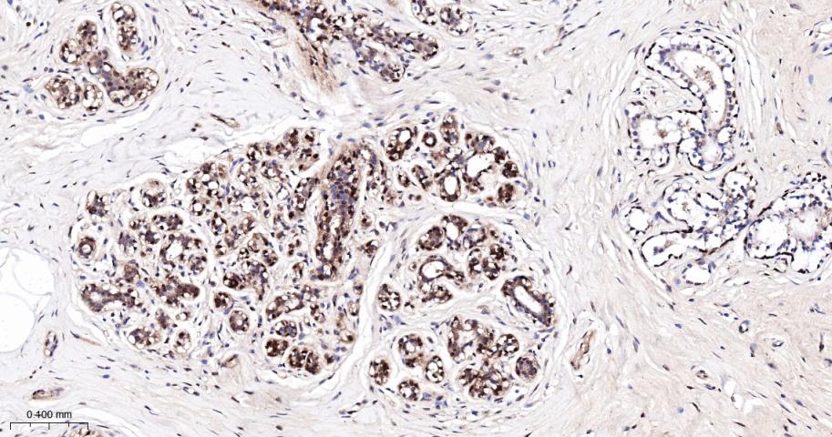 原癌基因Yes相关蛋白1重组兔单抗