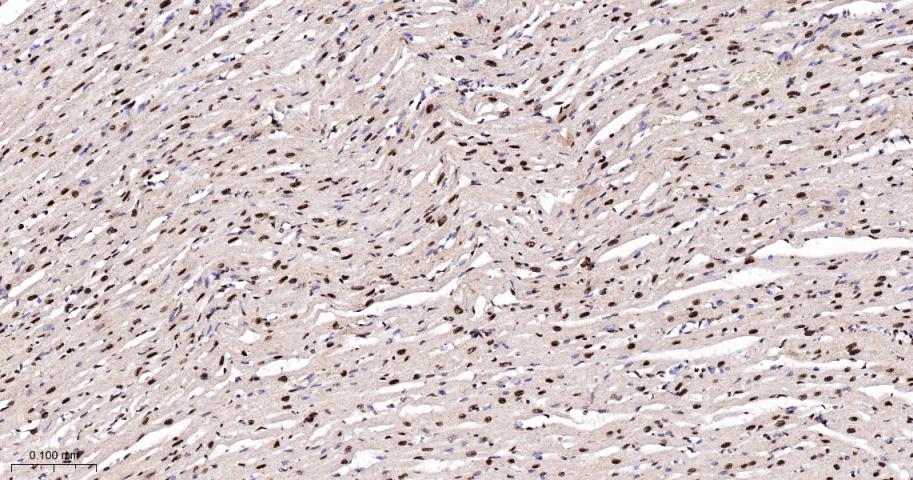 磷酸化细胞信号转导分子SMAD5重组兔单抗