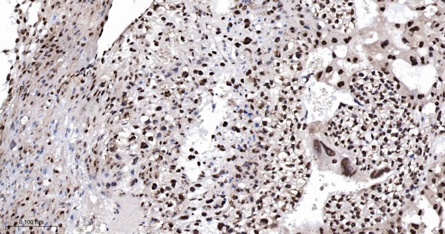 磷酸化细胞信号转导分子SMAD5重组兔单抗