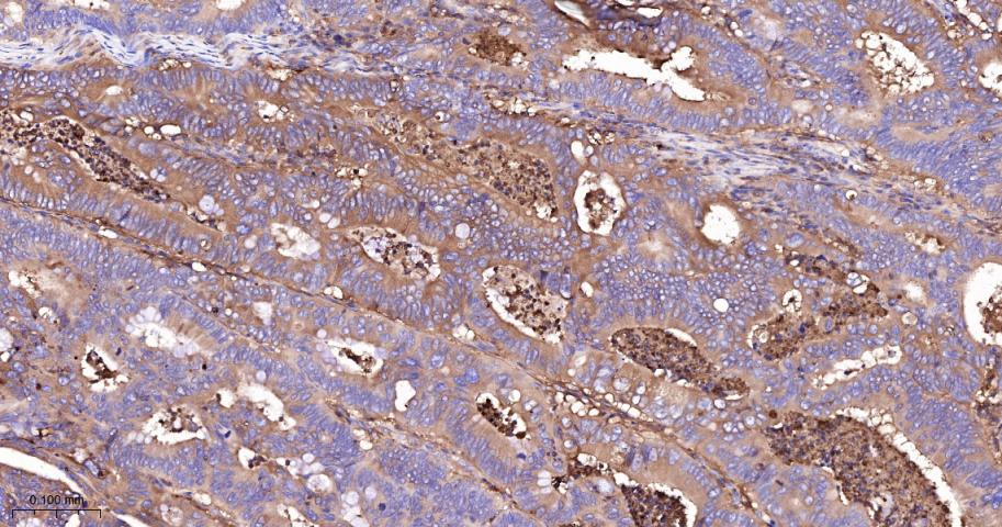 α-1抗胰糜蛋白酶/SERPINA3重组兔单克隆抗体