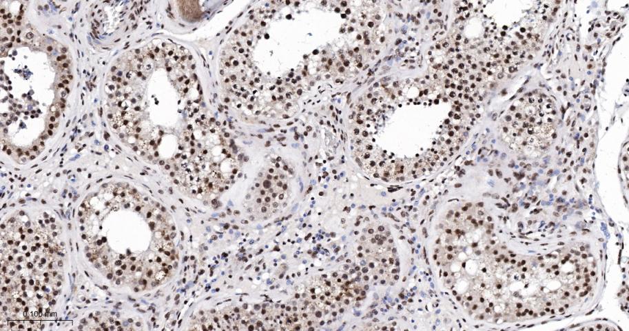 磷酸化细胞信号转导分子SMAD5重组兔单抗