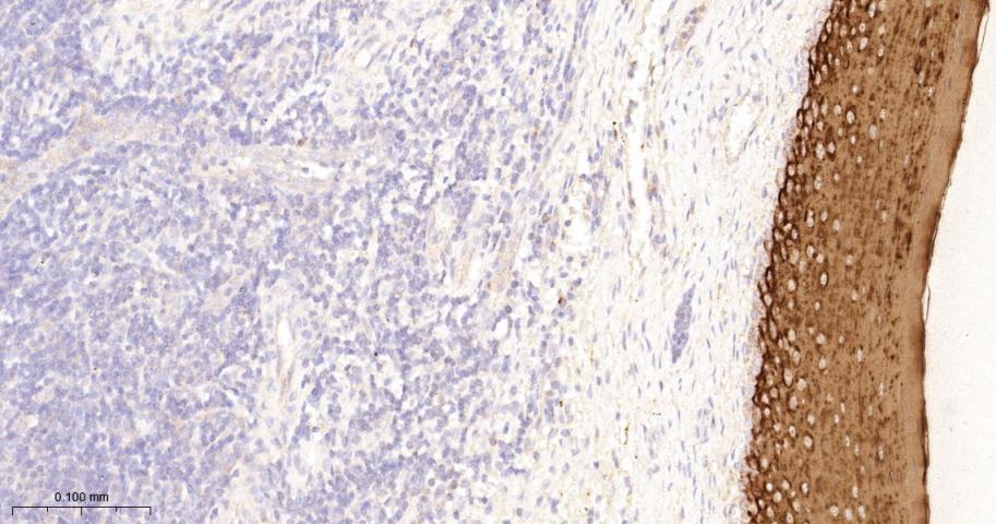 细胞角蛋白4重组兔单抗