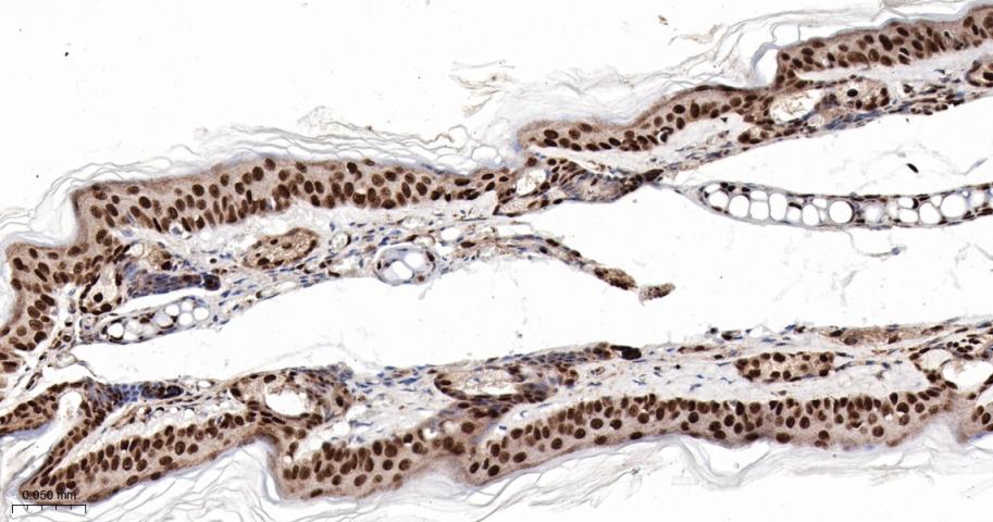 磷酸化细胞信号转导分子SMAD5重组兔单抗