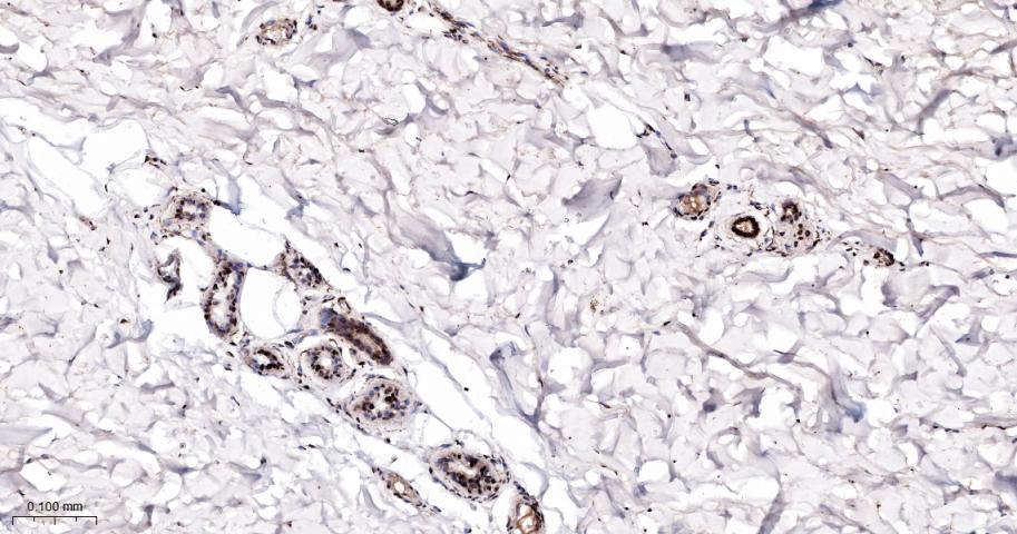 磷酸化细胞信号转导分子SMAD5重组兔单抗