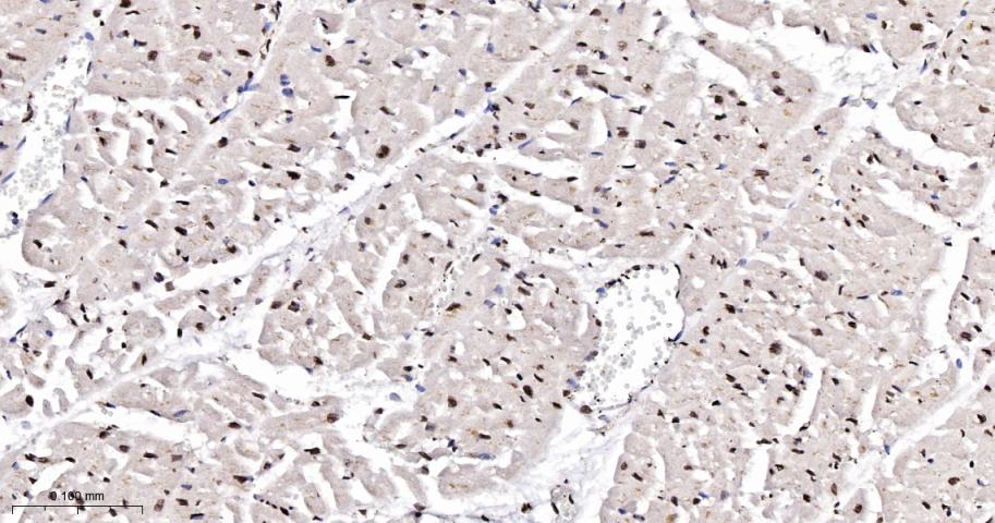 磷酸化细胞信号转导分子SMAD5重组兔单抗