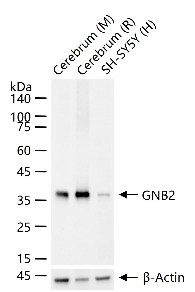 G蛋白β2重组兔单抗/鸟嘌呤核苷酸结合蛋白β亚基2重组兔单抗