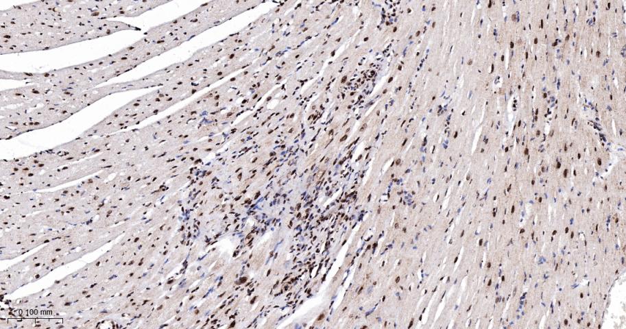 磷酸化细胞信号转导分子SMAD5重组兔单抗
