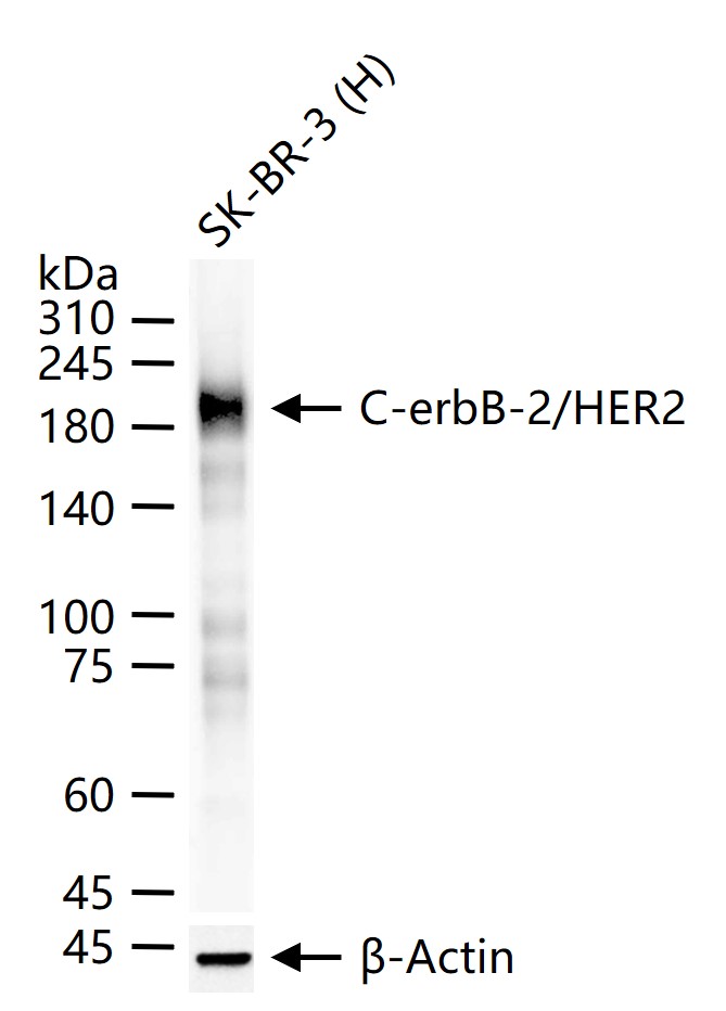C-erbB-2/HER2 Mouse mAb (一抗) - WB,IHC-P,IHC-F,IF | Bioss