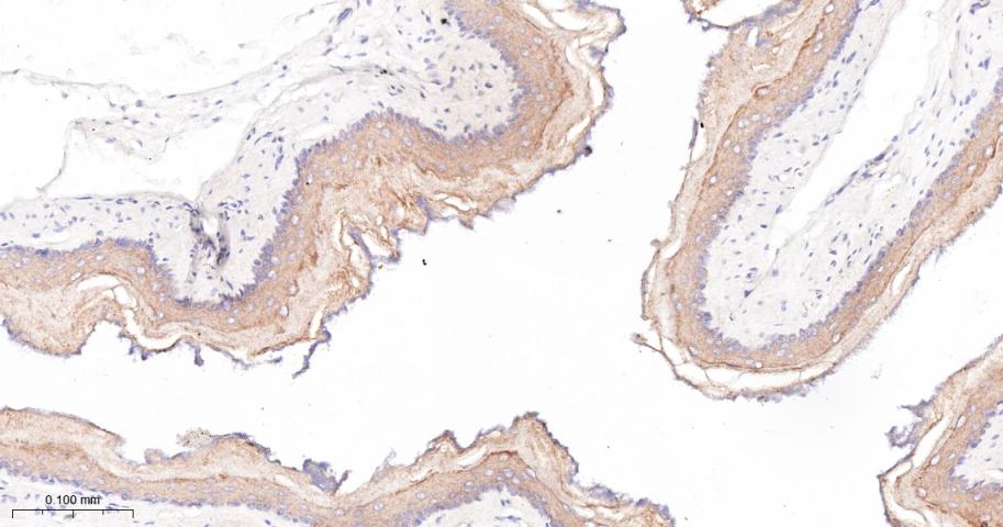 细胞角蛋白4重组兔单抗