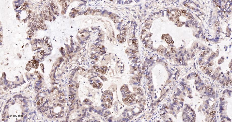 硫氧环蛋白还原酶1重组兔单抗